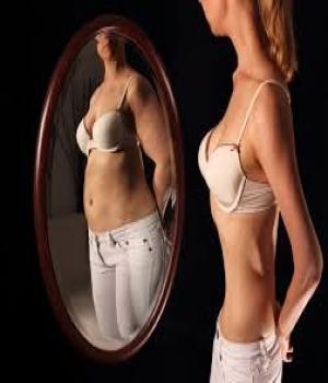 Anorexia nervosa