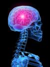 A migrén - Pszichoszomatika – test és lélek elválaszthatatlan