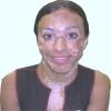 Vitiligo: Segít-e az önismereti, személyiségfejlesztő, stresszoldás tréning?